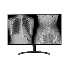 LG 32in Medical Ips 8mp Diagnostic Monitor 3840 X 2160 Dp Fda 510k Class Ii Taa (32HL512DB) LG 32in Medical Ips 8mp Diagnostic Monitor 3840 X 2160 Dp Fda 510k Class Ii Taa (32HL512DB)
